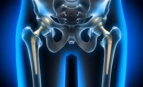 Hip Replacement Surgery Packages and EMI Options in Mohali